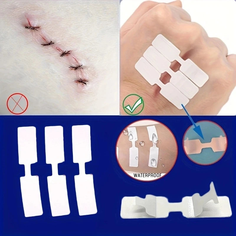 Outdoor Wound Adhesive Tape 5Pcs Disposable First Aid Bandages