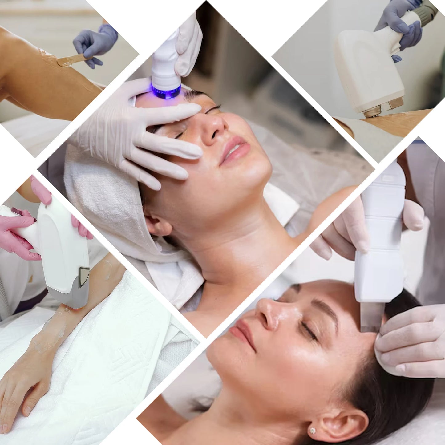 YMEYFAN Gel Conductor Radiofrequency Cavitation Ultrasound Treatments